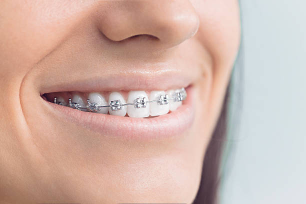 Best Veneers and Lumineers  in Lindenhurst, IL
